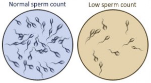 low-sperm-count